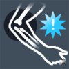 Tennis elbow